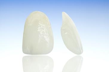 porcelain veneers lake oswego