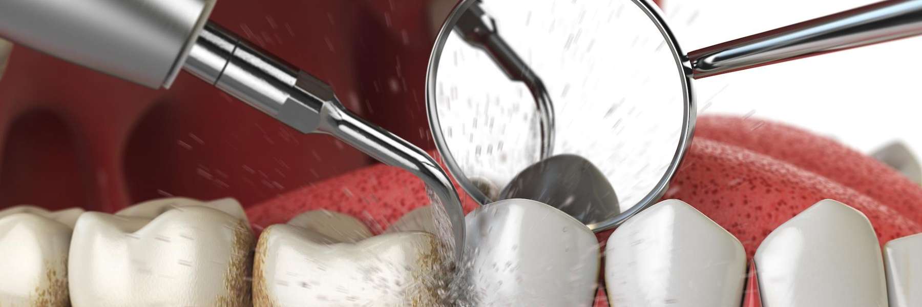holistic dentist lake oswego | dental cleaning