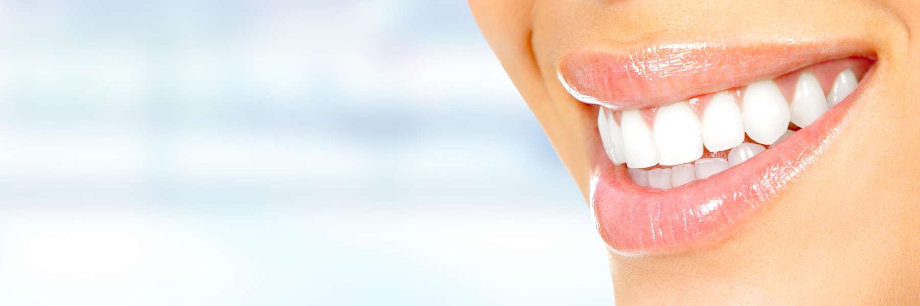 teeth whitening lake oswego