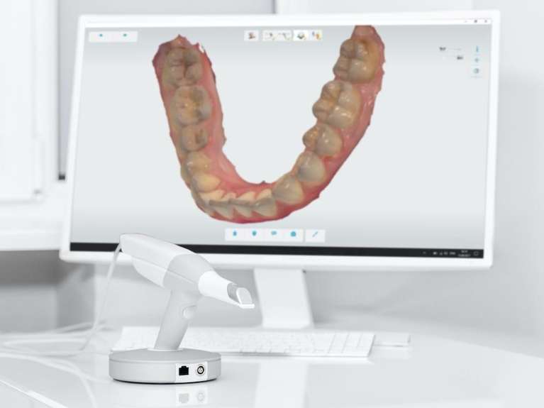 lake oswego dentist | digital impressions