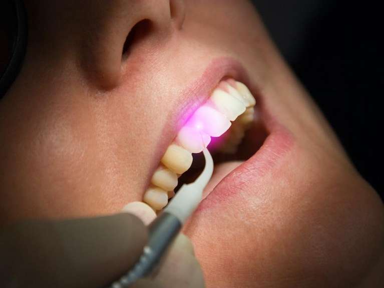 laser dentistry lake oswego | lake oswego dentist