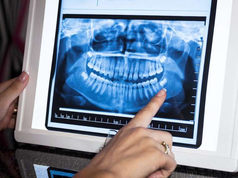 lake oswego dentist | panoramic x-ray